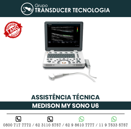 ASSISTENCIA TECNICA ULTRASSOM PORTATIL MEDISON MY SONO U6