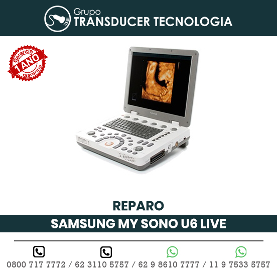 REPARO ULTRASSOM PORTATIL SAMSUNG MEDISON MY SONO U6 LIVE