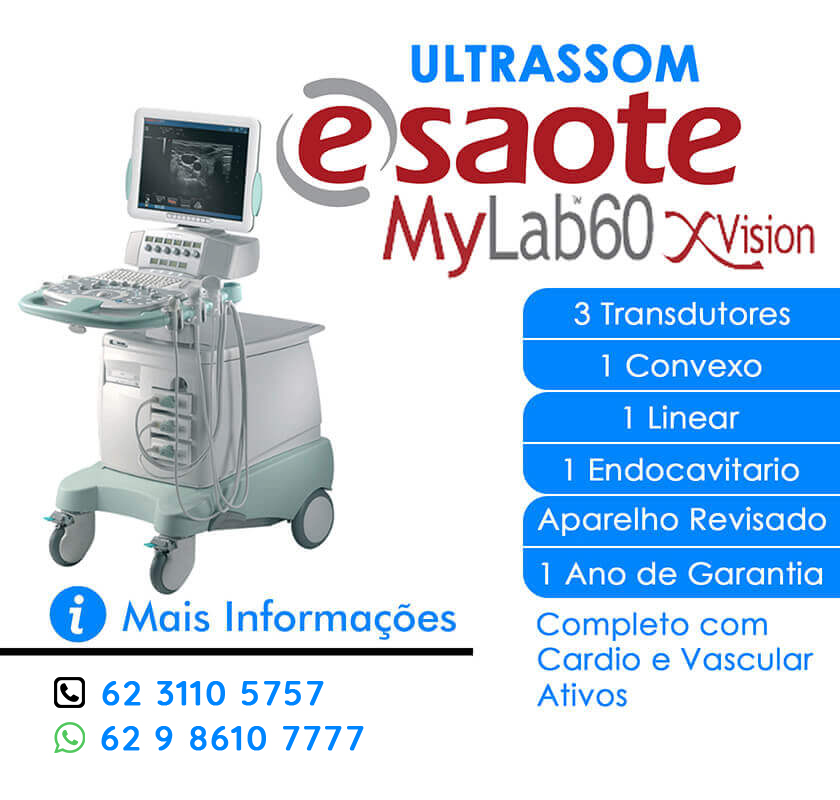VENDO ULTRASSOM ESAOTE MYLAB 60