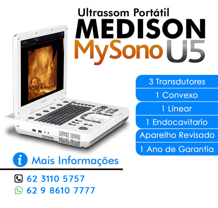 VENDO ULTRASSOM MEDISON MYSONO U5