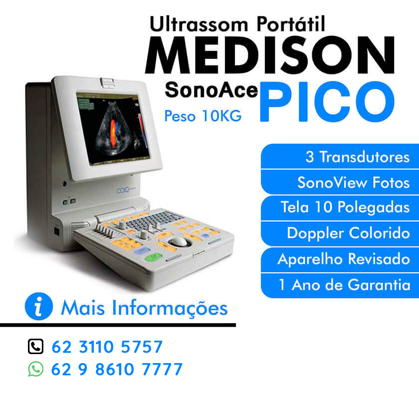 VENDO ULTRASSOM MEDISON PICO