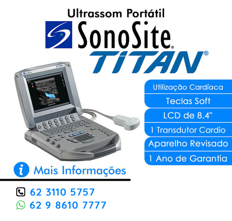 VENDO ULTRASSOM SONOSITE TITAN