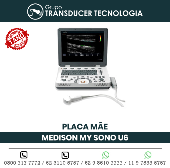 PLACA MAE ULTRASSOM PORTATIL MEDISON MY SONO U6